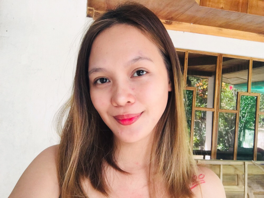 Microneedling Result after 2days